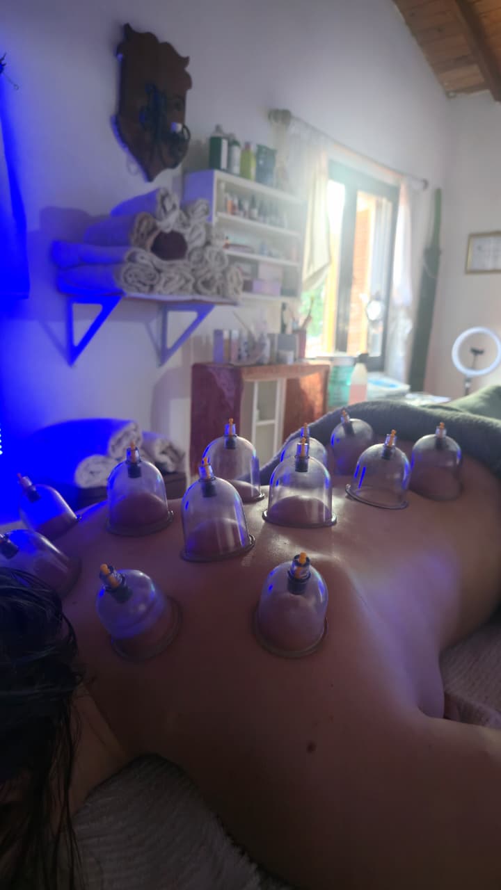 Cupping deportivo